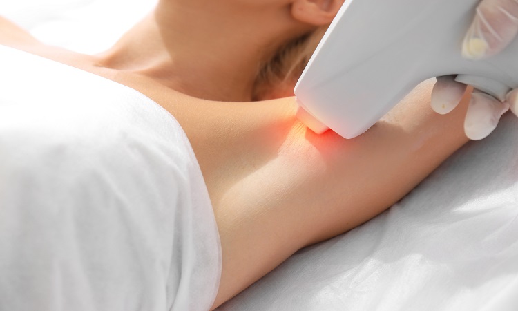 Πόσες Συνεδρίες Laser Αποτρίχωσης Χρειάζονται;